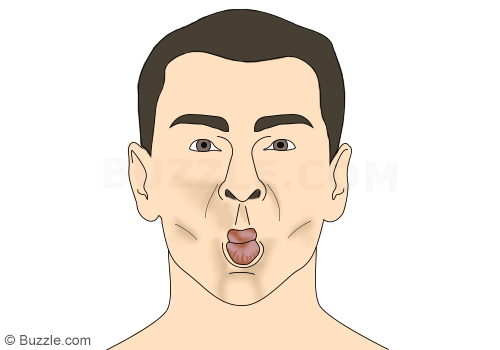 Cheeks Facial Exercise