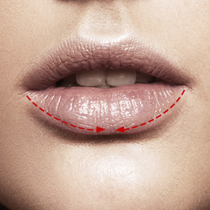 Apply lip liner over bottom lip