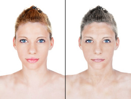 Aging Skin Problems