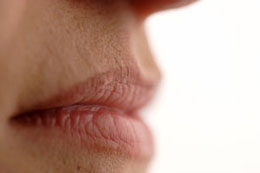 Upper Lip Wrinkles