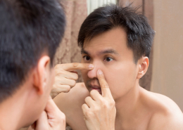 Nose Acne