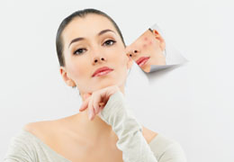 Cures for Acne During Your Period