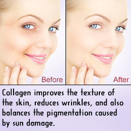 An Overview of Collagen Induction Therapy