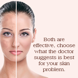 Laser Resurfacing or Chemical Peel: Which is Better?