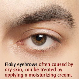 Causes and Home Remedies for Eyebrow Dandruff