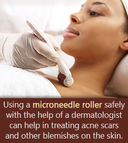 Microneedle Rollers: Are They Really Worth It?