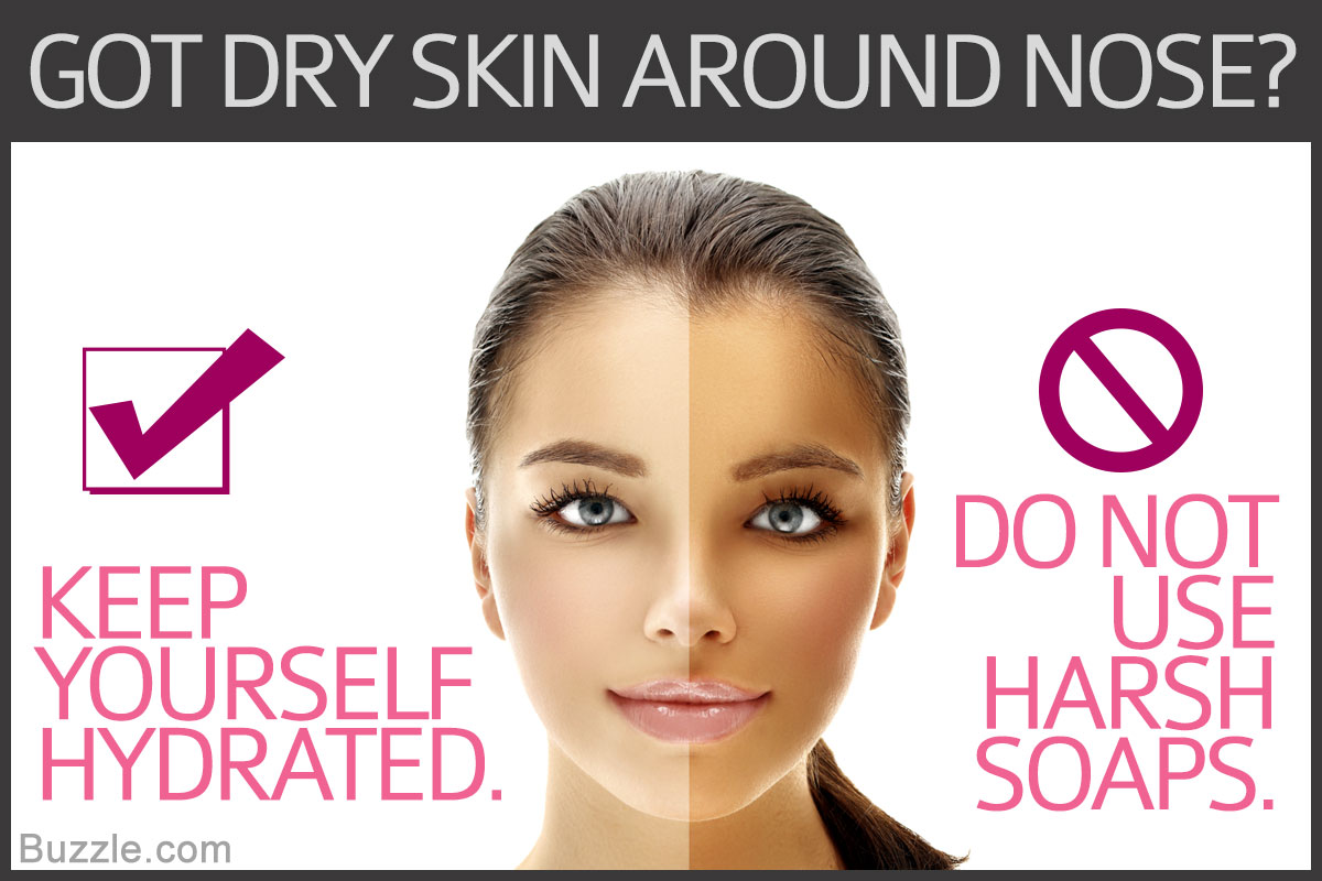 Dry Skin around Nose