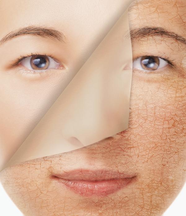 Smiling woman with new smooth skin