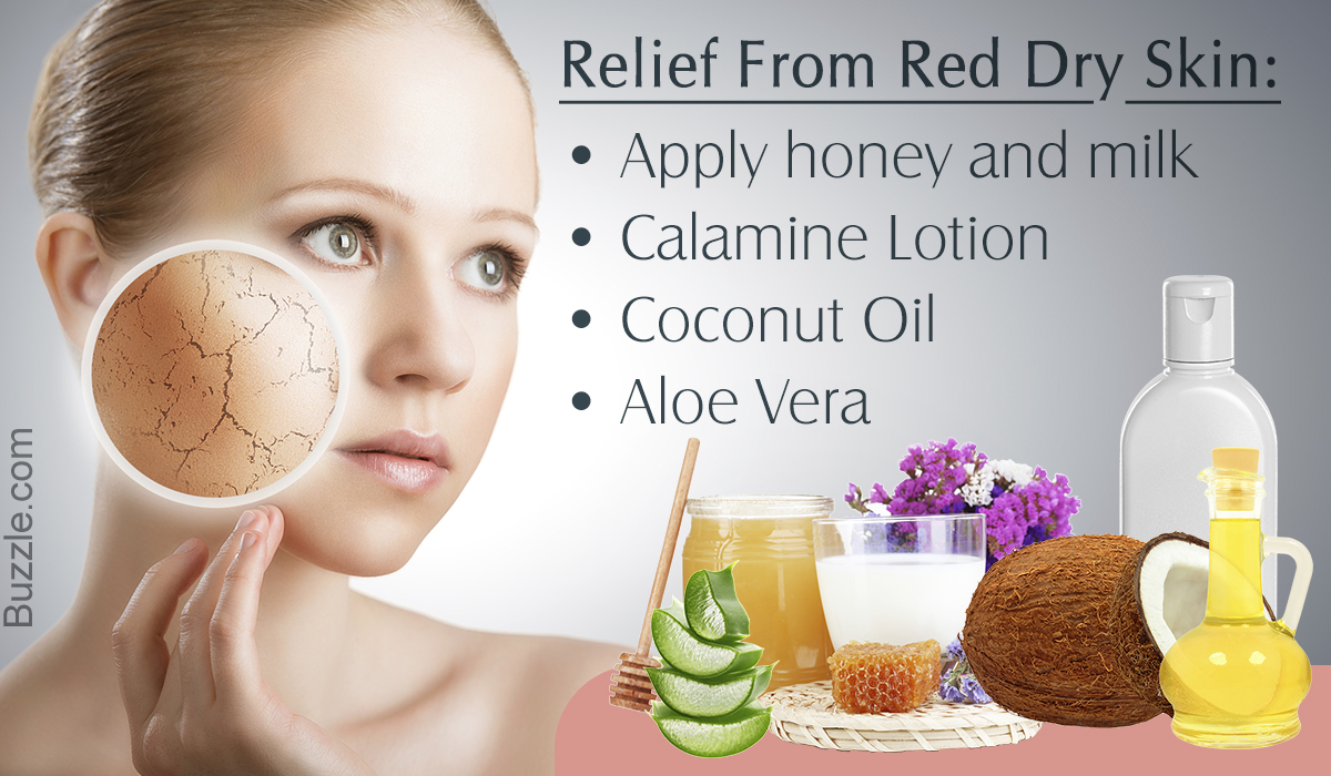 Remedies for Red Dry Skin on Face