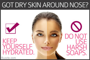Dry Skin around Nose