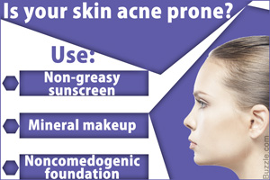 Best Makeup for Acne Prone Skin