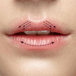 Applying Gloss