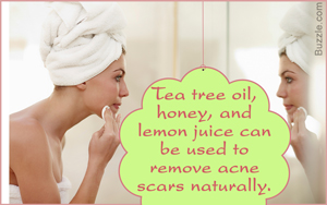 How to Clear Acne Scars Fast